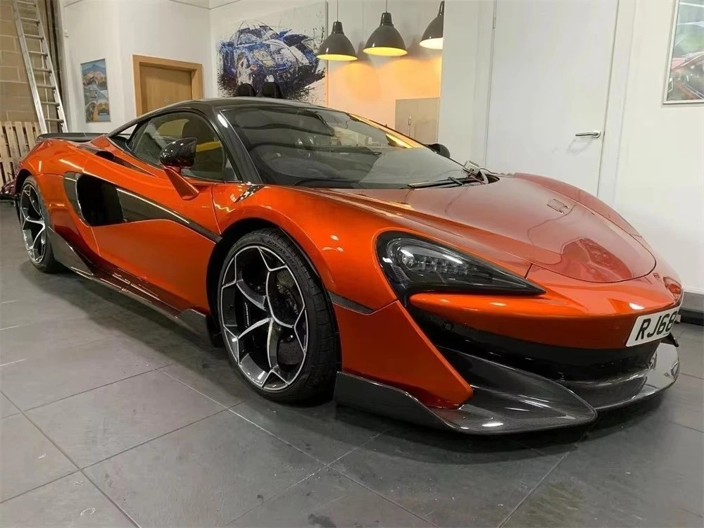 MSO Style Carbon Fiber Car Front Fender for  570S Body Kit 540C 570GT 2015-2018 Carbon Fiber Kit